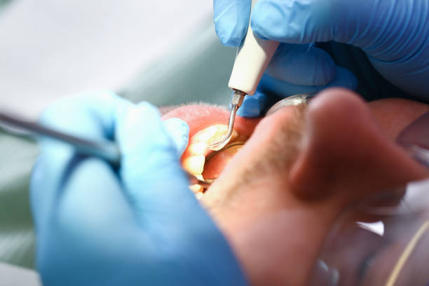 Best Emergency Orthodontic Repairs in Coralville, IA