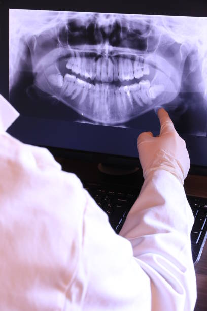 Best Emergency Treatment for Toothache in Coralville, IA