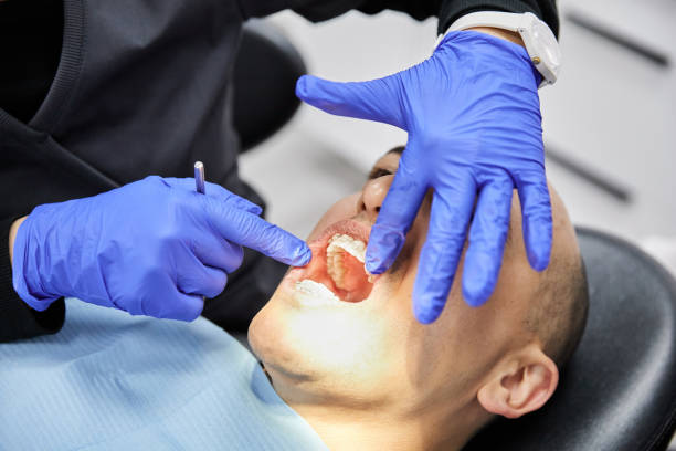 Best Emergency Broken Tooth Repair in Coralville, IA