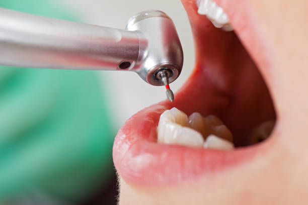 Best Emergency Treatment for Toothache in Coralville, IA